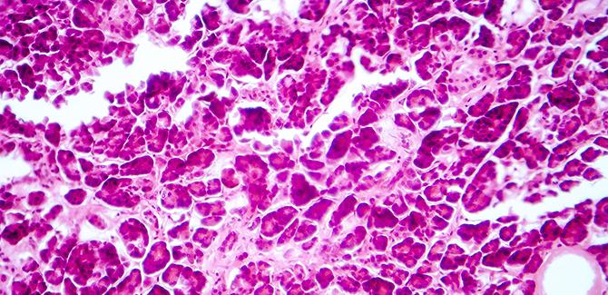 Research Sweden Cilia Cells And Diabetes Treatment Web