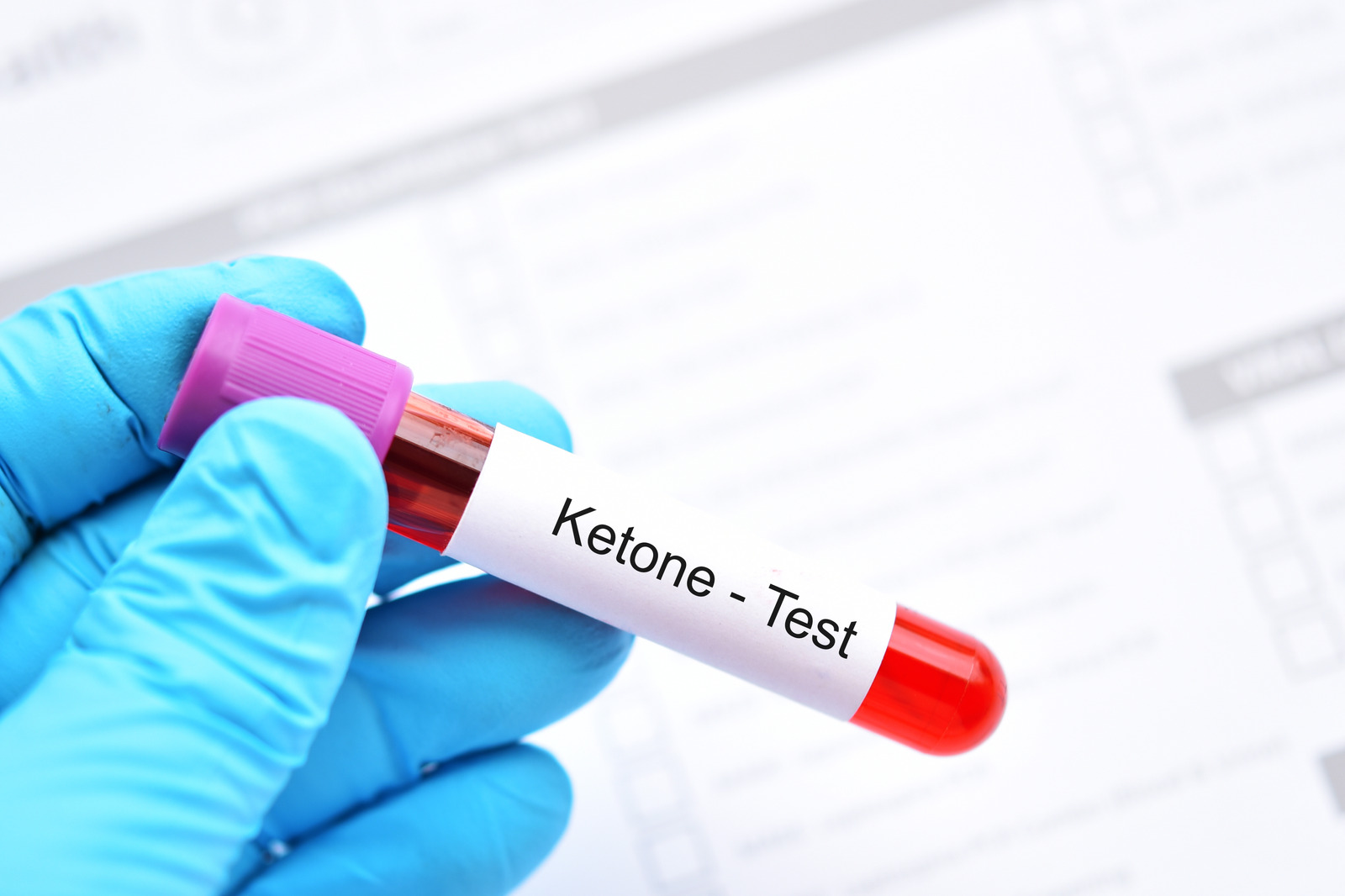 Blood Sample Tube For Ketone Test