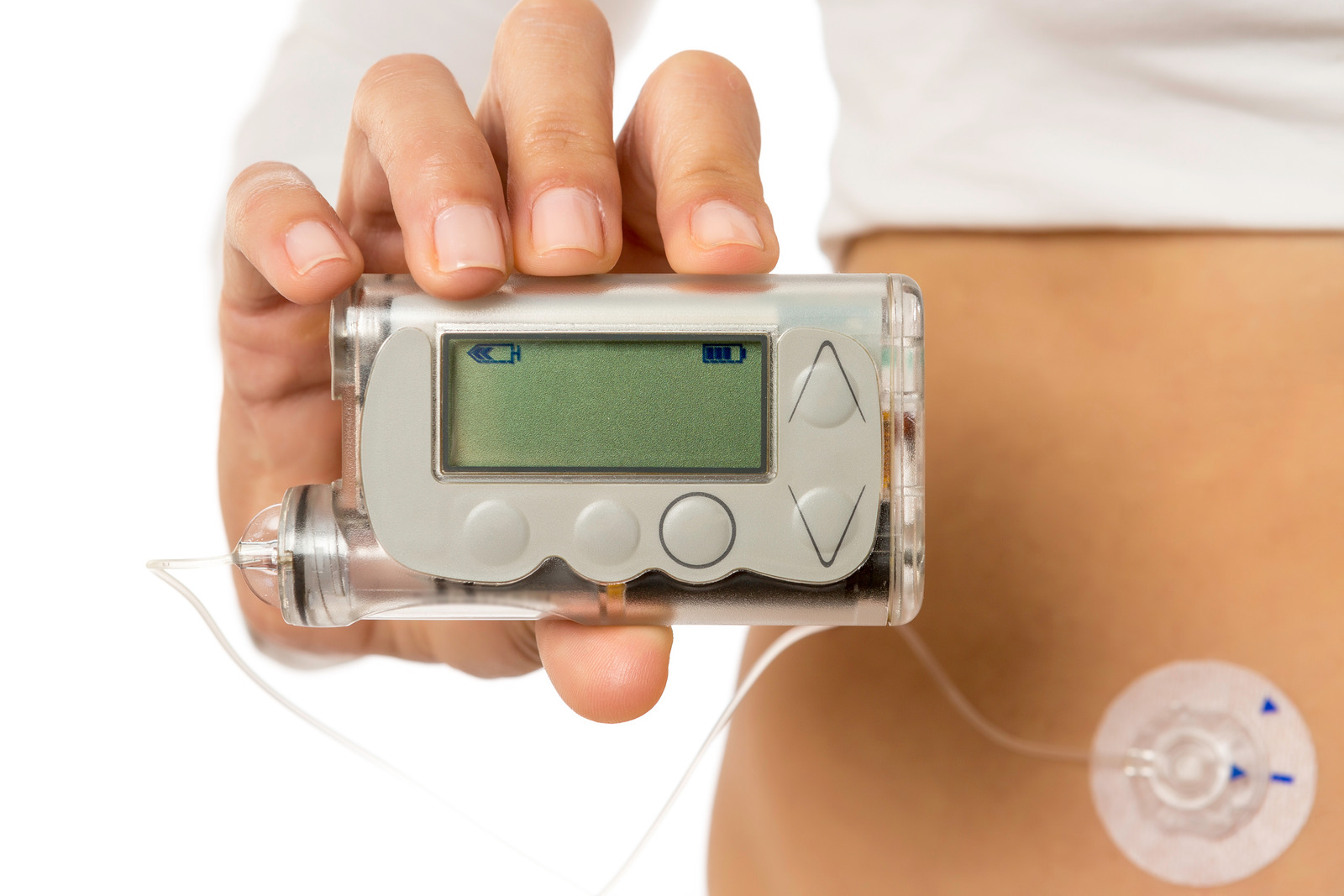 Person Holding Insulin Pump